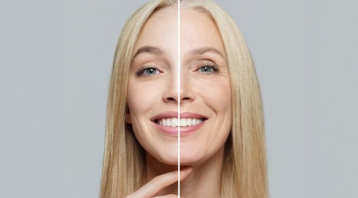 Najmocniejszy kwas hialuronowy w kapsułkach. Liftinguje skórę i wypełnia zmarszczki od środka