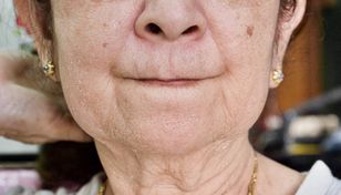 Hit na suchą skórę i zmarszczki. W aptece kupisz za kilka złotych