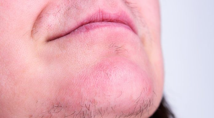 Włosy na brodzie to częsta przypadłość. Tak się ich pozbędziesz raz na zawsze