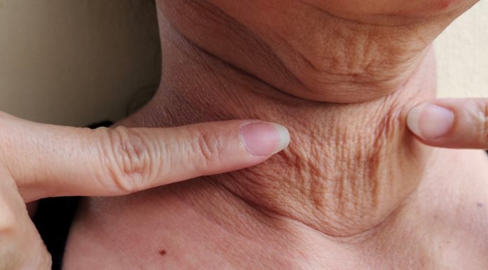 „Indycza szyja” to zmora wielu osób. Tak się jej pozbędziesz w tani sposób