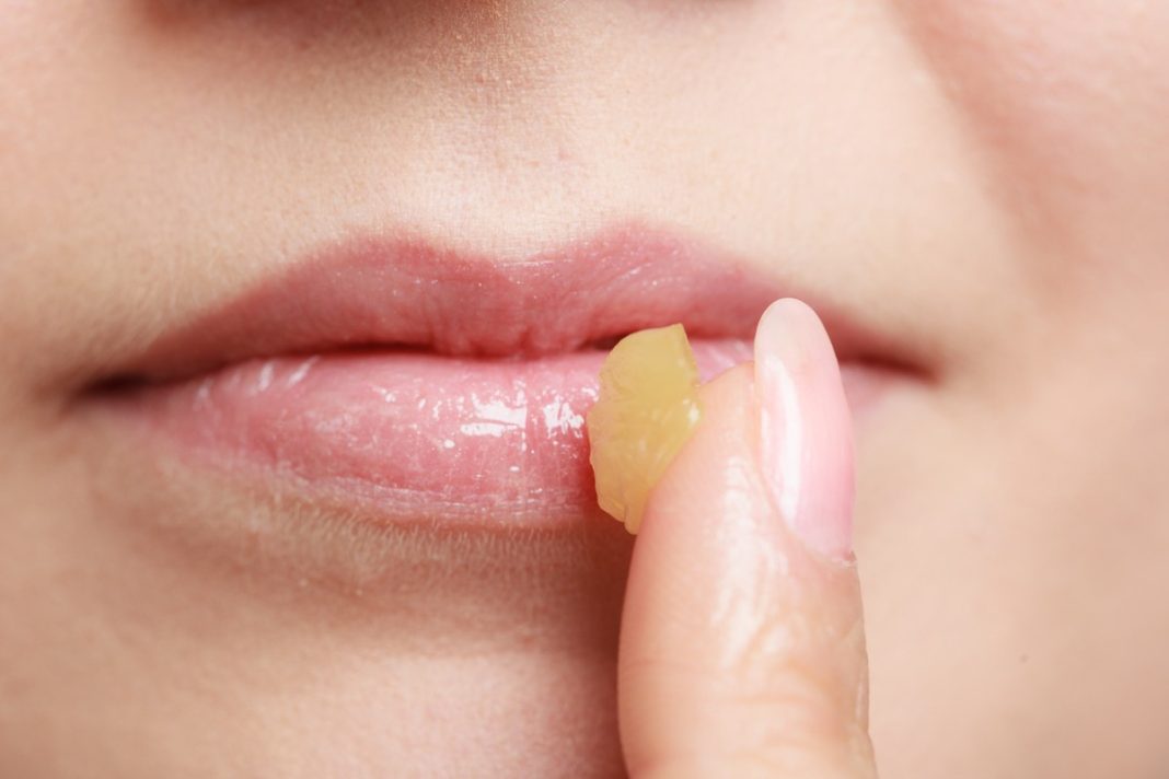 Ta maść uratuje popękane usta. Kupisz w aptece za 7 zł, a działa jak najdroższy balsam