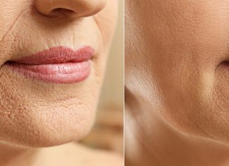 Cztery dobre sera z retinolem. Liftingują, wygładzają zmarszczki i zwężają pory