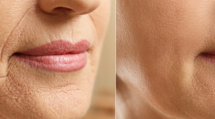 Cztery dobre sera z retinolem. Liftingują, wygładzają zmarszczki i zwężają pory