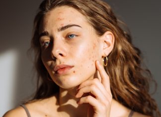 Trądzik nie odpuszcza, choć dawno już nie masz nastu lat? Ten koncentrat radzi sobie z nawracającymi niedoskonałościami w każdym wieku