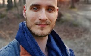 Aktor przeszczepił sobie w Turcji włosy. Lekarz ostrzega przed konsekwencjami