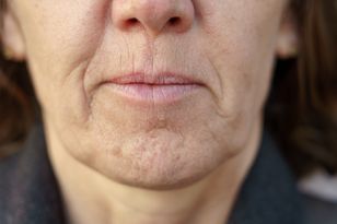 Hit na zmarszczki wokół ust. Zblenduj i nałóż na skórę