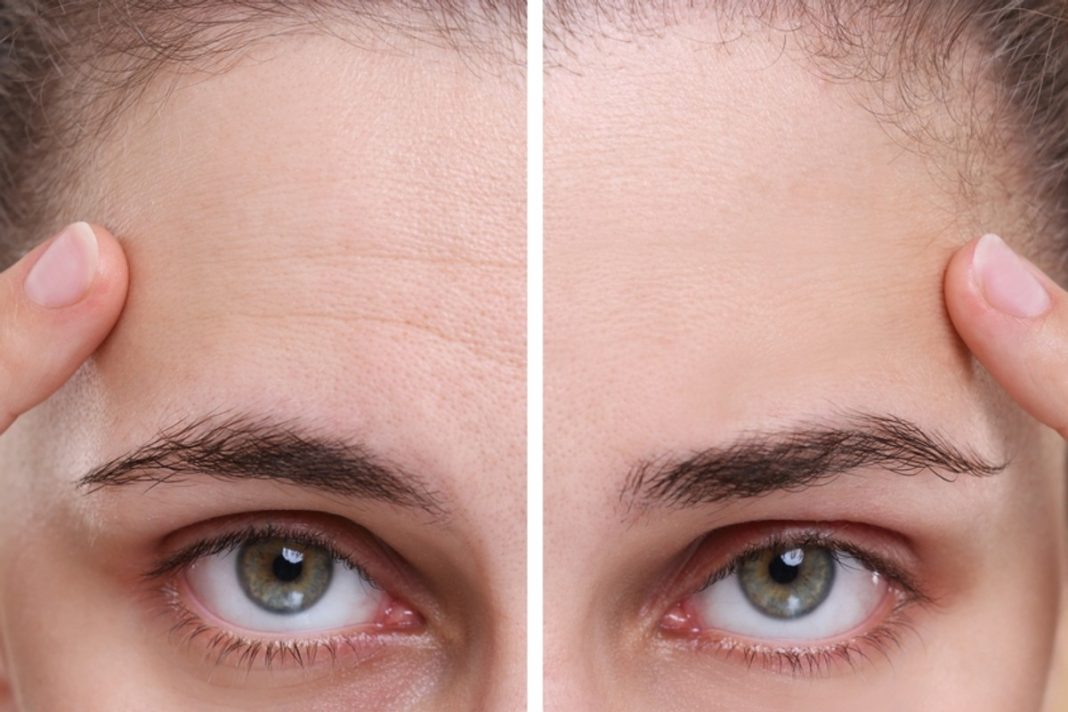 Te kremy to pogromcy zmarszczek mimicznych. Znów zaczniesz się szeroko uśmiechać