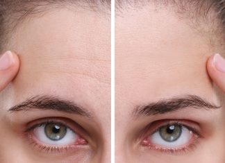 Te kremy to pogromcy zmarszczek mimicznych. Znów zaczniesz się szeroko uśmiechać