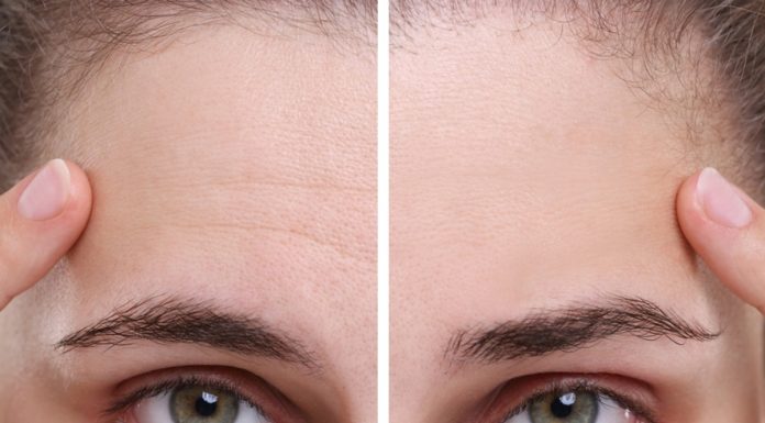 Te kremy to pogromcy zmarszczek mimicznych. Znów zaczniesz się szeroko uśmiechać