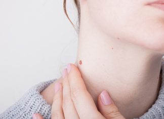 Trzy preparaty, które skutecznie usuną kurzajki