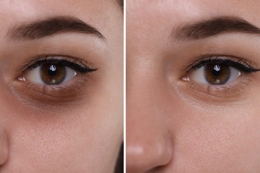 To najlepszy krem na opuchliznę pod oczami. Rozświetla, napina i zagęszcza skórę