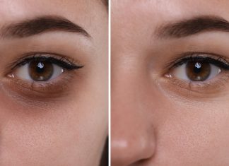 To najlepszy krem na opuchliznę pod oczami. Rozświetla, napina i zagęszcza skórę