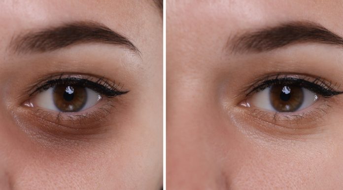 To najlepszy krem na opuchliznę pod oczami. Rozświetla, napina i zagęszcza skórę