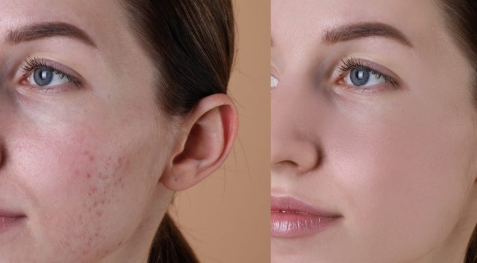 Mineralny krem z witaminą A to zbawca problematycznej skóry. „Używam od lat”