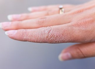 TOP kremy na szorstkie dłonie. Najlepszy kosztuje 16 zł i działa jak kojący opatrunek