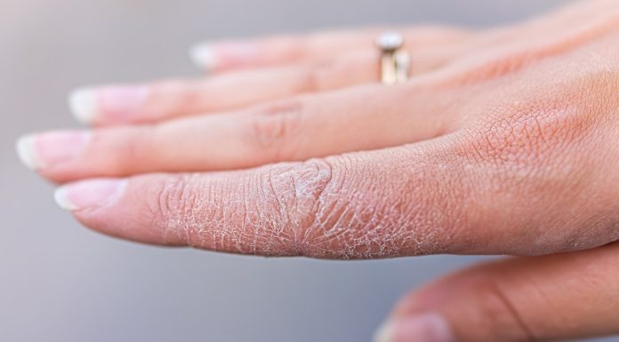 TOP kremy na szorstkie dłonie. Najlepszy kosztuje 16 zł i działa jak kojący opatrunek