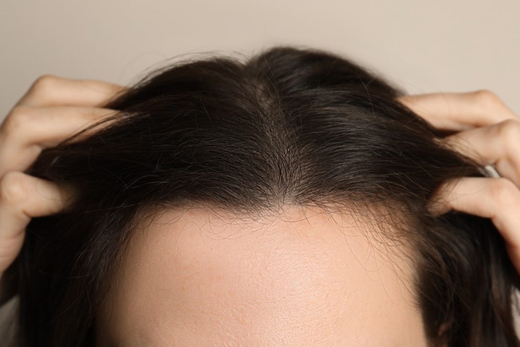 Masz problem z wypadaniem włosów? Wypróbuj szampon wzmacniający. Mamy pięć dobrych preparatów