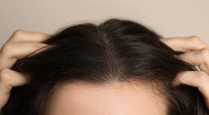 Masz problem z wypadaniem włosów? Wypróbuj szampon wzmacniający. Mamy pięć dobrych preparatów