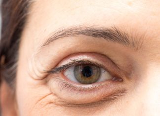 Pięć świetnych kremów pod oczy, które redukują opuchliznę. Zapomnij o workach pod oczami!