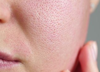 Najlepsze kosmetyki zwężające pory — sprawdzone serum na zaskórniki