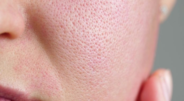 Najlepsze kosmetyki zwężające pory — sprawdzone serum na zaskórniki