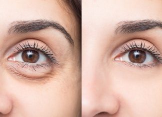 Kremy z kofeiną, dzięki którym pozbędziesz się worków pod oczami