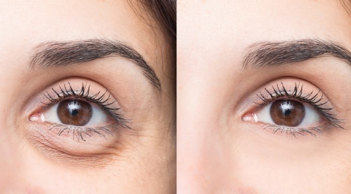 Kremy z kofeiną, dzięki którym pozbędziesz się worków pod oczami