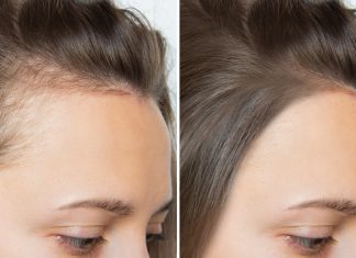 Najlepsza rozgrzewająca wcierka na przerzedzenia i zakola to ta. „Znowu pokochałam kucyk”