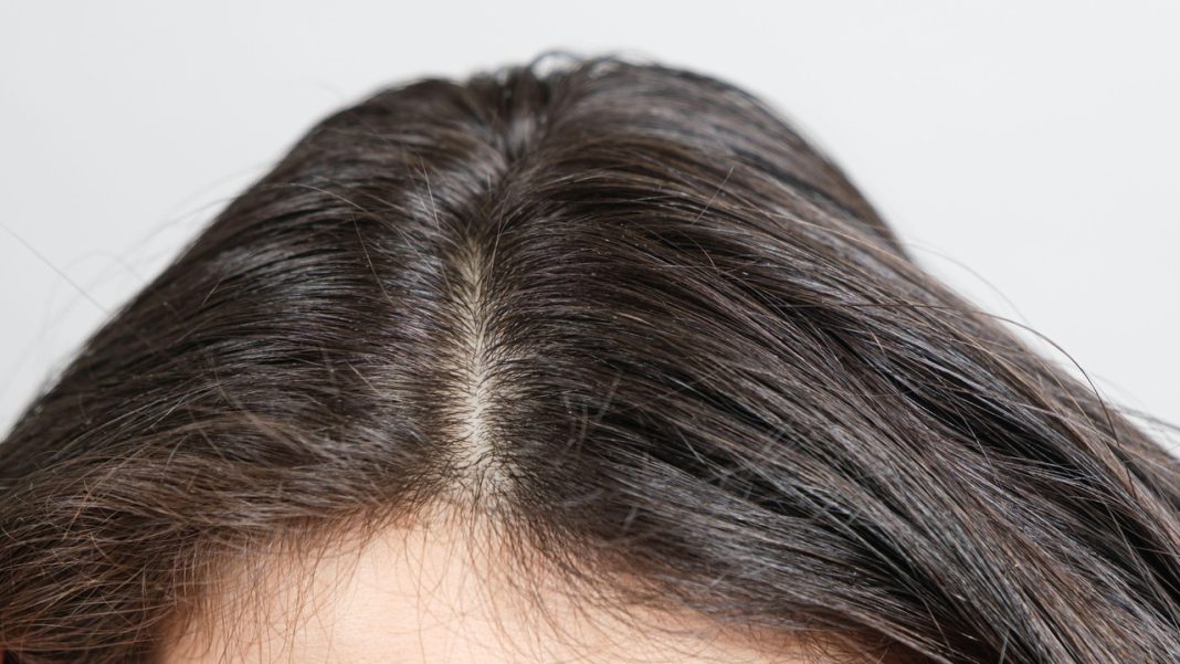 Co się stanie, kiedy przestaniesz myć głowę? Trycholożka wyjaśnia