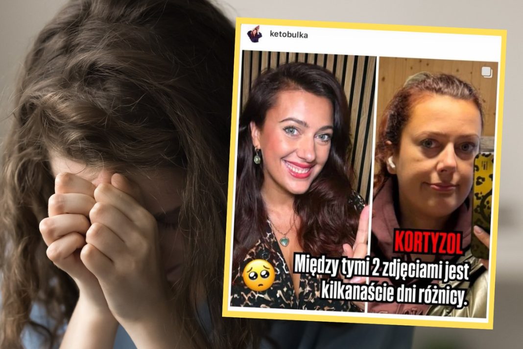 Pokazała, jak wygląda kortyzolowa twarz. Te zdjęcia dzielą dni