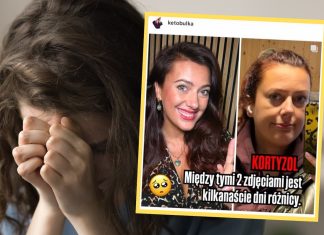 Pokazała, jak wygląda kortyzolowa twarz. Te zdjęcia dzielą dni