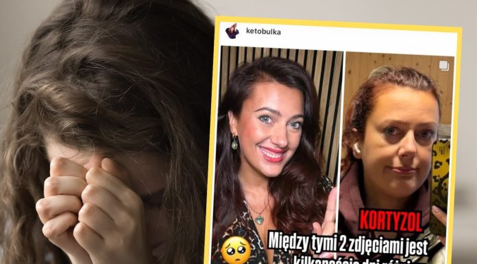 Pokazała, jak wygląda kortyzolowa twarz. Te zdjęcia dzielą dni