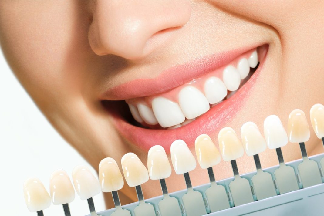 Pasta za 14 zł to hit dla kawoszy. Usuwa nawet utrwalone brązowe przebarwienia, rozjaśnia zęby w 5 dni