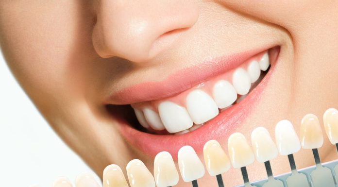 Pasta za 14 zł to hit dla kawoszy. Usuwa nawet utrwalone brązowe przebarwienia, rozjaśnia zęby w 5 dni