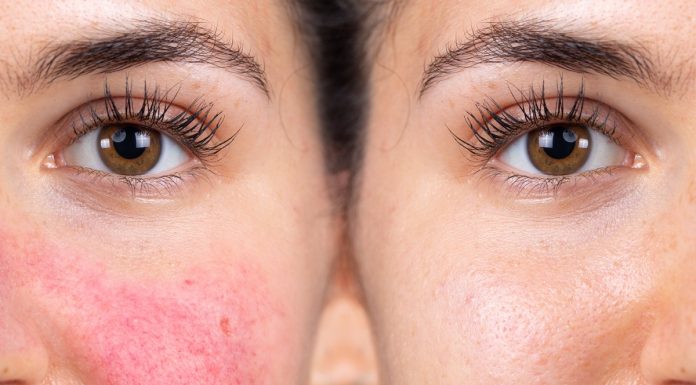 Silnie nawilżający krem do suchej skóry. Kosztuje grosze i ma tysiące pozytywnych opinii