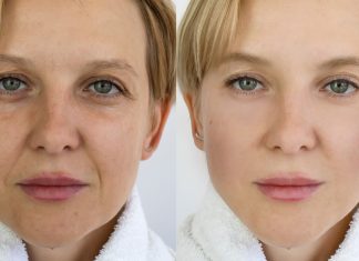 Ten mocny kolagen z jadem żmii daje efekt pełnego liftingu. Szybko przywraca utraconą jędrność