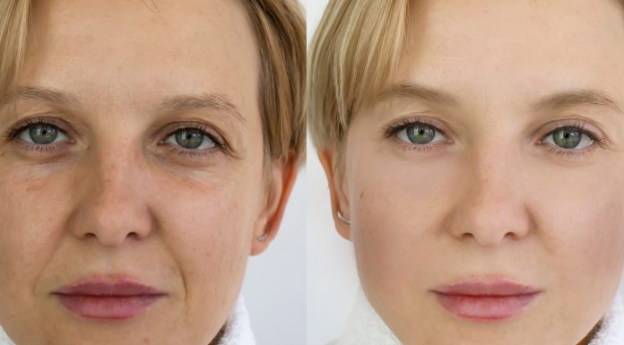 Ten mocny kolagen z jadem żmii daje efekt pełnego liftingu. Szybko przywraca utraconą jędrność