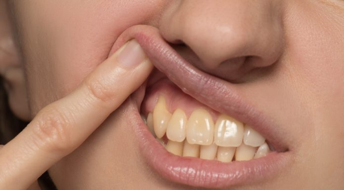 Ten napój najmocniej przebarwia zęby