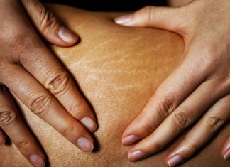 Kultowy balsam na widocznie po odchudzaniu i ciąży rozstępy