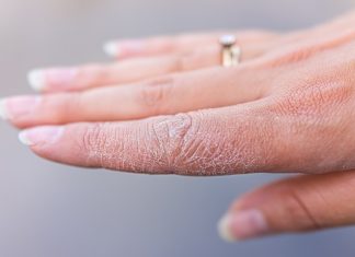 Nawilżasz dłonie i ciągle są suche? Ten krem błyskawicznie pomoże