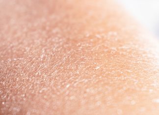 Sucha, swędząca skóra? Te balsamy przyniosą ci ulgę i wygładzą skórę