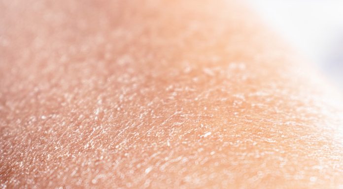 Sucha, swędząca skóra? Te balsamy przyniosą ci ulgę i wygładzą skórę