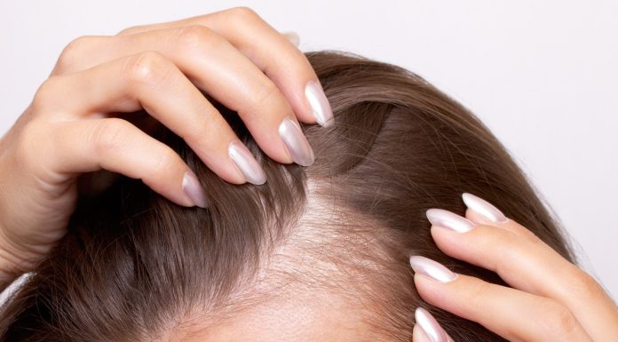 TOP 3 kolageny z końską dawką biotyny. Wzmacniają przerzedzone włosy od środka, wygładzą skórę