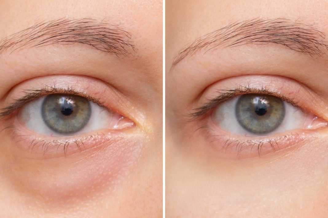 Tani krem pod oczy z wiśniami wypełnia skórę nawilżeniem.