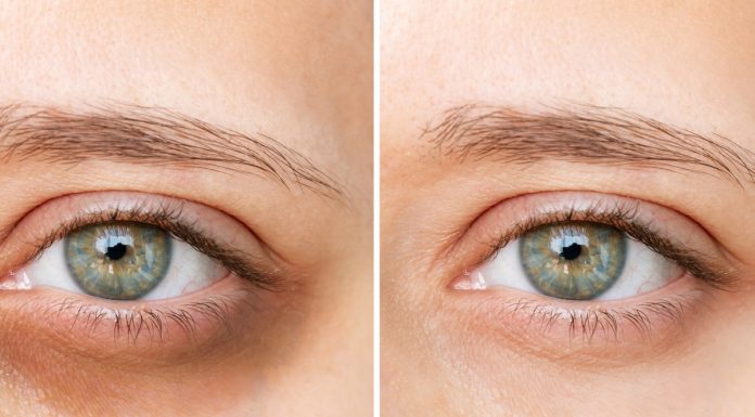 Ten rozjaśniający krem przywraca „błysk w oku”. Eliminuje worki i opuchliznę