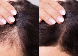 Trzy wcierki, które są mało znane, a szkoda! „Nidy nie miałam tyle baby hair”