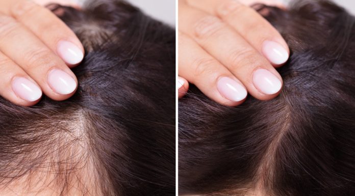 Trzy wcierki, które są mało znane, a szkoda! „Nidy nie miałam tyle baby hair”