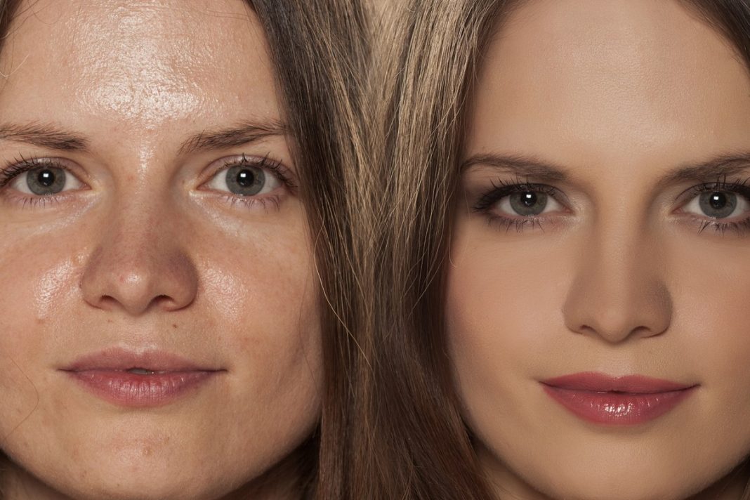 Trzy matujące kremy do twarzy, z którymi zapomnisz o święcącej się cerze