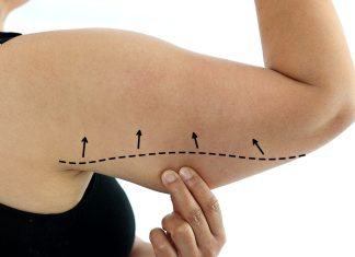 Wiotka skóra na ramionach? Ten wyszczuplający koncentrat to pogromca pelikanów