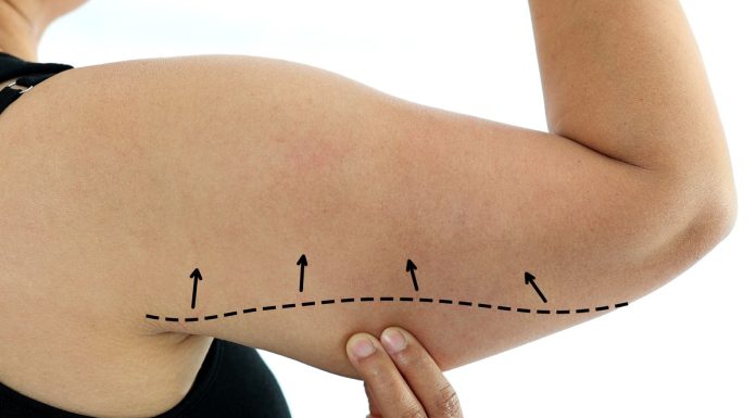 Wiotka skóra na ramionach? Ten wyszczuplający koncentrat to pogromca pelikanów